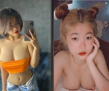 Kim Xu bị nên miệng cười như c*t